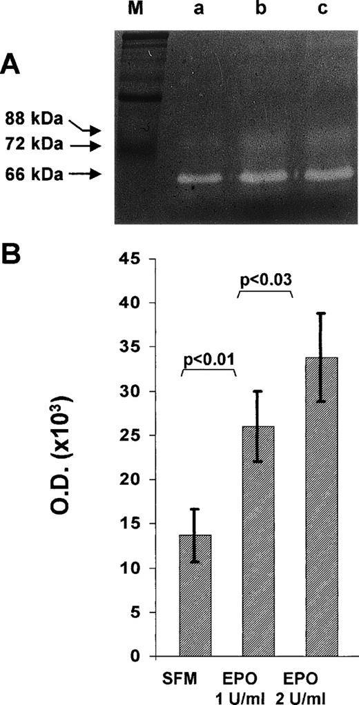 Fig. 3. Effect of rHuEpo on MMP-2 production in EA.hy926 cells. Subconfluent EA.hy926 cells were cultured for 24 hours in serum free medium in the absence (SFM) or in the presence of the indicated concentrations of rHuEpo. After incubation, the conditioned medium was analyzed by gelatin-zymography as described in Materials and Methods. (A) One representative experiment showing the presence of a Mr 62,000 gelatinolytic band corresponding to activated MMP-2 in the conditioned medium of control (a), 1 U/mL rHuEpo (b), and 2 U/mL rHuEpo (c) treated cells. M, molecular weight markers. (B) Quantitation of MMP-2 activity by computerized image analysis of the gelatinolytic bands. Data are the mean ± SD of eight independent experiments (statistical analysis by Student’s t-test).