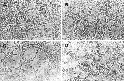 Fig. 4. Morphogenic activity of rHuEpo. EA.hy926 cells were seeded on Matrigel and incubated in DMEM added with 0.1% BSA (A) or with 0.5 U/mL (B), 1.0 U/mL (C), or 2.0 U/mL (D) rHuEpo. After 6 hours, cells were photographed using an inverted phase contrast photomicroscope. A dose-dependent morphogenetic effect of rHuEpo was observed.
