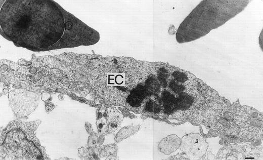 Fig. 6. Ultrastructural features of rHuEpo-treated CAM vasculature. An ultrathin section showing a mitotic endothelial cell (EC) in rHuEpo-treated CAM. Bar is 0.3 μm.