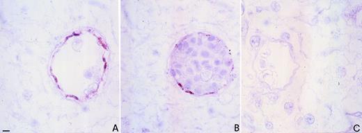 Fig. 7. Immunohistochemical localization of EpoR in CAM. Immunoperoxidase staining of an 8-day-old chick embryo CAM using polyclonal antibodies to factor VIII (A) and anti-EpoR (B). Note the coexpression of factor VIII and EpoR on vascular endothelial cells. The negative control (preimmune serum replacing the primary antibody) is shown in (C). Bar for (A) through (C) is 5 μm.