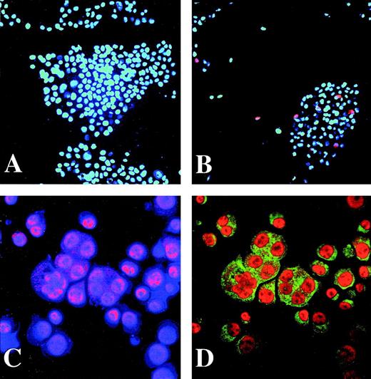 Fig. 5. Fli-1 protein is expressed in human megakaryocytes. A and B show immunohistochemical analysis for Fli-1 expression in 293T cells that were transiently transfected with either nonspecific plasmid (A) or the Fli-1 expression construct CMVFli-1 (B). Hoechst DNA staining is cyan and Fli-1 staining is red. Regions that colocalize for DNA and Fli-1 staining appear as magenta. Panels C and D show CD34+ cells that were treated with 10 ng/mL of thrombopoietin for 7 days before triple staining. Panel C shows Hoechst DNA stain (blue) and Fli-1 (red). Areas of colocalization appear as magenta. Panel D displays the same cells as panel C showing GPIIb antigen (green) and Fli-1 (orange). In panel D Fli-1 appears as orange. Original magnification of panels A and B was 40× and panels C and D was 200×.