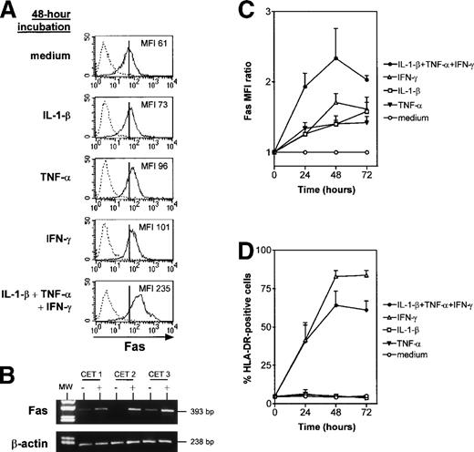 Fig. 3. IL-1-β, TNF-, and IFN-γ, alone and in combination, upregulate Fas expression in cultured TEC. TEC subcultured after 10 to 13 days of primary culture were incubated with the cytokines. At 24, 48, or 72 hours, TEC were collected by trypsin treatment and labeled with anti–HLA-DR or anti-Fas antibody. (A) A representative experiment shows that, after 48 hours of incubation, IL-1-β, TNF-, and IFN-γ, both alone and together, increased Fas MFI. Vertical bars on Fas staining histograms indicate the Fas MFI level in TEC cultured in control conditions, ie, in medium. (B) mRNA was extracted from TEC cultured without (−) or with (+) 1 ng/mL IL-1-β, 10 ng/mL TNF-, and 500 U/mL IFN-γ. Lane 1 corresponds to the molecular weight (MW) marker (pUC18 DNA Marker Hae III digest; Sigma). mRNA was submitted to RT-PCR. In three independent experiments, cytokine-activated TEC showed a strong increase in Fas mRNA levels in comparison to TEC cultured in control conditions, whereas β-actin expression was not modified. (C) The MFI ratio is the ratio between Fas MFI measured in the presence of one or several cytokines and Fas MFI measured in control conditions. MFI ratios are expressed as a function of time. Results are means ± SEM of four independent experiments. (D) The proportion of HLA-DR–positive cells was analyzed in the same experiments.