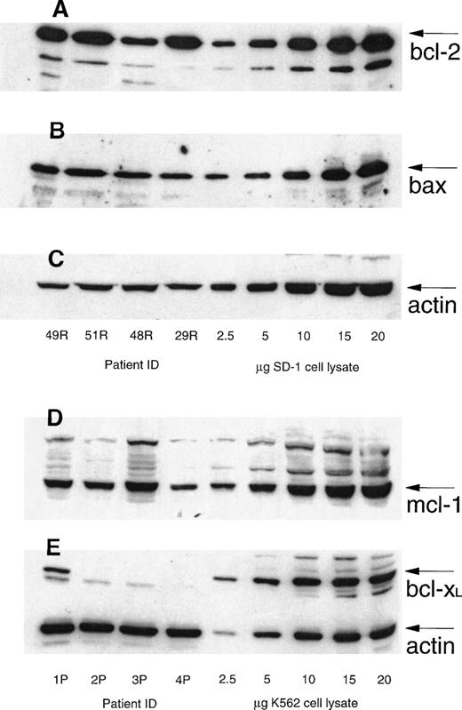 Fig. 1. Immunoblot showing level of expression of BCL-2, BAX, MCL-1, and BCL-XL with corresponding standards from SD1 cells (in the case of BCL-2 and BAX) and K562 cells (in the case of MCL-1 and BCL-XL). Actin is included as a loading control.