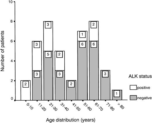 Fig. 1. ALK expression in patients with primary nodal ALCL in relation to age.