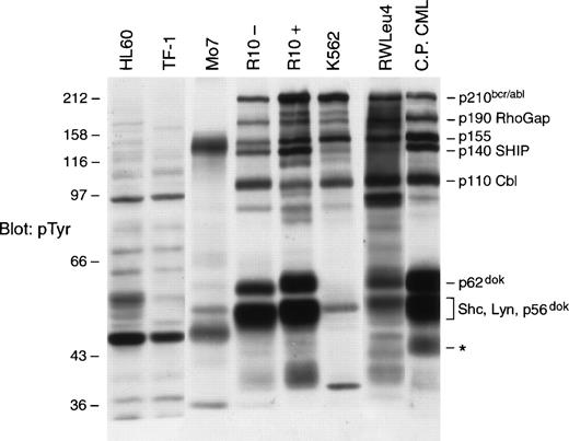 Fig. 1. Analysis of Ptyr proteins constitutively present in p210bcr/abl-expressing cells. NP-40 lysates (50 μg), obtained from p210bcr/abl-negative (HL60, TF-1, and M07) and p210bcr/abl-positive (R10−, R10+, K562, and RWLeu4) cell lines as well as CP CML progenitor cells (CP CML), were separated by SDS-PAGE and transferred to Immobilon. The membrane was probed with anti-Ptyr MoAb, 4G10, and developed with the ECL detection system. Molecular weight markers are indicated on the left side of the panel and are in kilodaltons. The asterisk on the right side of panel indicates a Ptyr protein in primary CP CML cells that reacts with an antibody raised against p62dok. This suggests it may be a degradation product or isoform of p62dok.
