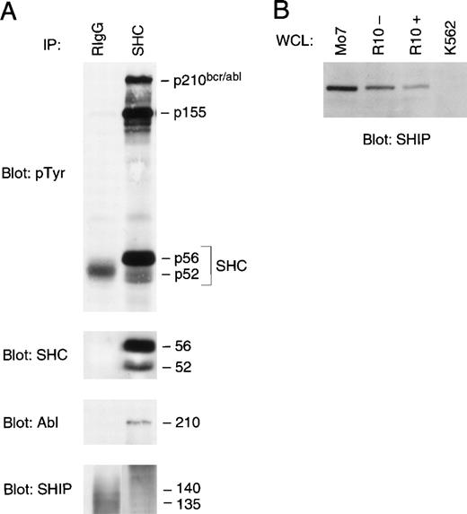 Fig. 2. A 155-kD tyrosine phosphorylated protein is unrelated to p140 SHIP and coimmunoprecipitates with SHC from K562 lysates. (A) NP-40 lysates of K562 cells (10 × 106) were immunoprecipitated (IP) with rabbit antibodies to SHC or to mouse IgG (RIgG; which served as a control antibody). Immunoprecipitates were separated in 7.5% SDS-PAGE gels, transferred to Immobilon, and immunoblotted with the antibodies indicated on the left of each panel. Each immunoblot represents a reprobing of the same filter. Molecular weights (in kilodaltons) are indicated on the right side of each panel. Please note that the p140 SHIP polyclonal antibody used for blotting (8727) is directed against the carboxyl amino acids 1103-1192 of human SHIP. (B) NP-40 lysates (WCL; 50 μg) from M07, R10−, R10+, and K562 cell lines were separated by SDS-PAGE, transferred to Immobilon, and immunoblotted with p140 SHIP polyclonal antibody 5340 that is directed against amino acids 670-868 of p140 SHIP.