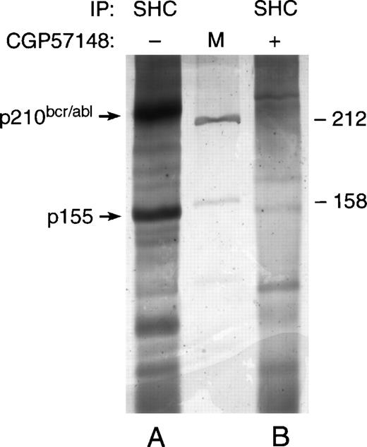 Fig. 3. Quantitative analysis of the Ptyr 155-kD protein in anti-SHC immunoprecipitates from K562 lysates. K562 cells either untreated (lane A) or treated overnight with the tyrosine kinase inhibitor, CGP57148 (lane B), were lysed. NP-40 lysates (200 × 106 cell equivalents) were immunoprecipitated with an anti-SHC polyclonal antibody and the resulting precipitates were separated in a 6% SDS-PAGE gel. The resolved proteins were then detected by silver staining. Standard molecular weight marker proteins (50 ng/protein) were run simultaneously (M).