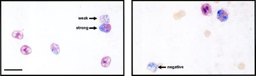 Fig. 4. Double immunolabeling of circulating PMN for surface L-selectin (red) and nuclear BrdU (blue). BrdU-labeled PMN were classified according to the intensities of L-selectin expression as strong, weak, and negative. The bar represents 10 μm.