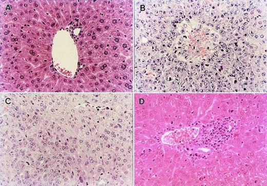 Fig. 4. Histopathological examination of the liver obtained from normal BDF1 and the recipients of B6 TCD-BM, B6 BM, or B6 BMS in the GVL experiment shown in Fig 3A. (A) Liver section from an age-matched normal BDF1 mouse. (B) Massive leukemia cell infiltration was observed in the liver section from the recipients of B6 TCD-BM at the time of death. (C) Liver section obtained from the recipients of B6 BM on day 28 after BMT showed residual leukemia cells among normal liver tissue. (D) Liver section from the recipients of B6 BMS on day 28 after BMT showed severe mononuclear cell infiltration, but there was no residual leukemia cell in any fields of the section. Each figure shows a representative of three similar experiments. Similar results were also observed by using another tumor P815 cells. Original magnification × 400.