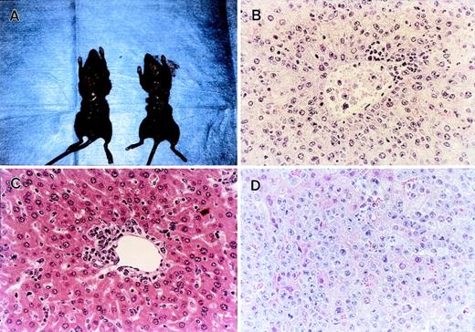 Fig. 6. Histopathological examination of the GVL experiments shown in Fig 5A. (A) Administration of anti–TNF- MoAb resulted in early death with marked hepatosplenomegaly (left) compared with an age-matched normal mouse (right). The liver section obtained at the time of death showed massive leukemia infiltration (B). (C) Liver section obtained from gld BMS recipients on day 28 showed focal mononuclear infiltration around portal area, but there was no residual leukemia cells in any fields of the section. Residual leukemia cell was not detected in spleen, BM, or peripheral blood. (D) Residual leukemia cells were observed in small areas of the liver section from the PKO BMS recipients. Each figure shows a representative of three similar experiments. Similar results were also observed by using another tumor P815 cells. Original magnification × 400.