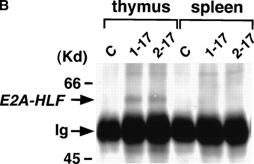 Fig. 1. (A) Schematic model of the injection fragment for generating E2A-HLF transgenic mice. The Ig enhancer/promoter, the E2A-HLF cDNA, and the SV40 early splicing and poly(A) signals are shown as white, black, and shaded boxes, respectively. The positions of primers used for RT-PCR (P1-P4) are also indicated. The bar shows 1 kb. (B) Western blot analysis for the expression of theE2A-HLF transgene product in the thymus and spleen of a control mouse (C) and a transgenic mouse from two independent lines (1-17 and 2-17). The positions of E2A-HLF protein and Ig are indicated by arrows, and the positions of the molecular marker are shown on the left. (C) Immunofluorescent staining of the transgenic spleen with anti-B220 and anti-HLF antibodies. The B220-expressing and HLF-expressing cells are visualized by green and red signals, respectively.