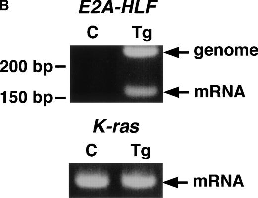 Fig. 7. (A) Flow cytometric analysis of the B-cell colonies generated from bone marrow of a transgenic mouse (Tg) and a nontransgenic control (C) with anti-B220 and anti-CD43 antibodies (4 weeks of age). Colonies established from transgenic mice and nontransgenic controls are similarly positive for B220 and show the same broad pattern for CD43. (B) Expression of transgene-derived mRNA in the transgenic B-cell colonies. The RT-PCR products of the transgenic colonies (Tg) and nontransgenic colonies (C) were electrophoresed in an agarose gel, stained with ethidium bromide, and photographed. In the top panel (E2A-HLF), products of genomic and mRNA amplification are indicated by arrows and the position of the DNA size markers are shown on the left. In the bottom panel (K-ras), K-ras RT-PCR products are shown as an internal control.