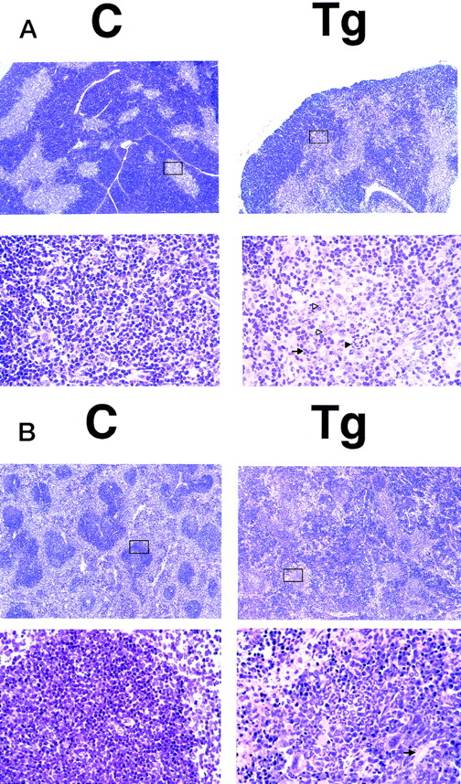 Fig. 4. HE-stained sections of the thymus (A) and spleen (B) of a transgenic mouse (Tg) and a nontransgenic control (C) (4 weeks of age). The boxed areas in the top panels are magnified in the bottom panels. (A) Thymus. In the lower magnification (top panels), transgenic thymus shows enlargement of the medulla and obscurity and irregularity of the medulla/cortex junction. In the higher magnification (bottom panels), the medulla of the transgenic thymus contains fewer thymocytes and consists of epithelial and interdigitating cells. Infiltrated neutrophils and multi-nucleated giant cells are indicated by black and white triangles, respectively, and the tingeble-body macrophages are indicated by an arrow. (B) Spleen. In the lower magnification (top panels), transgenic spleen shows marked disorganization in the fundamental structures. In the higher magnification (bottom panels), in a white pulp of the transgenic spleen, lymphocytes are markedly reduced and proliferation of neutrophils and megakaryocytes is observed. The central splenic artery, which is located in the middle of the white pulp, is indicated by an arrow.