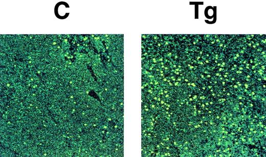 Fig. 5. TUNEL staining of the thymus of a transgenic mouse (Tg) and a nontransgenic control (C) (4 weeks of age). Apoptotic thymocytes are detected as yellow signals and background cells are seen as green signals. The transgenic thymus exhibits increased number of thymocytes undergoing apoptosis.