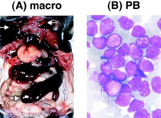 Fig. 8. Pathological analysis of acute leukemia developed inE2A-HLF transgenic mice. (A) Macroscopic appearance of a leukemic mouse. The enlarged thymus and spleen are indicated by black and white triangles, respectively, and subcutaneous lymph node swellings are indicated by arrows. (B) WG-stained peripheral blood smear of a leukemic mouse. Massive proliferation of lymphoblasts is apparent. (C through F) HE-stained thymus (C), spleen (D), liver (E), and kidney (F) of a leukemic mouse. The fundamental structures of the thymus and the spleen are destructed due to massive proliferation of leukemic cells (C and D, respectively) and infiltration of leukemic cells is detected around the blood vessels in the liver and the kidney (E and F, respectively).