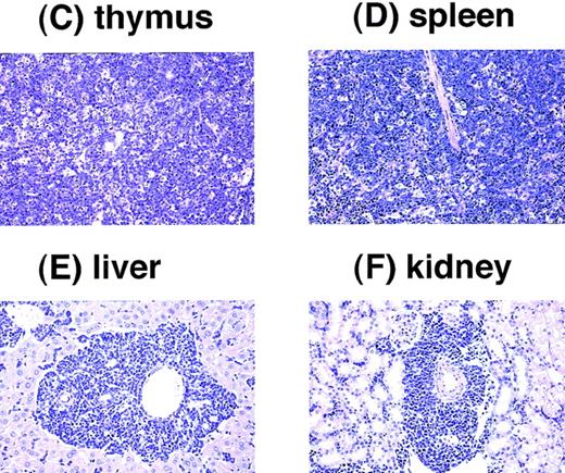 Fig. 8. Pathological analysis of acute leukemia developed inE2A-HLF transgenic mice. (A) Macroscopic appearance of a leukemic mouse. The enlarged thymus and spleen are indicated by black and white triangles, respectively, and subcutaneous lymph node swellings are indicated by arrows. (B) WG-stained peripheral blood smear of a leukemic mouse. Massive proliferation of lymphoblasts is apparent. (C through F) HE-stained thymus (C), spleen (D), liver (E), and kidney (F) of a leukemic mouse. The fundamental structures of the thymus and the spleen are destructed due to massive proliferation of leukemic cells (C and D, respectively) and infiltration of leukemic cells is detected around the blood vessels in the liver and the kidney (E and F, respectively).