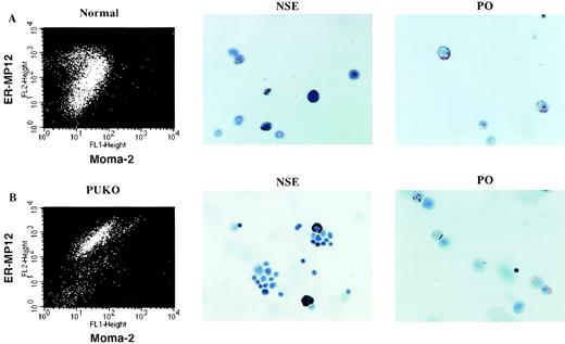 Fig. 6. Cells showing monocytic enzyme characteristics are found in both the normal and PU.1−/− double staining populations. The MP12+Moma-2+ population from normal and PU.1−/− livers was isolated using magnetically labeled antibodies (see Materials and Methods). Flow cytometry data show the enrichment of the double positive cells from (A) normal and (B) PU.1−/− livers. Cytochemical stains of normal or PU.1−/− MP12+Moma-2+ cells for NSE (black stain) and peroxidase (PO; red stain) activity are also presented.