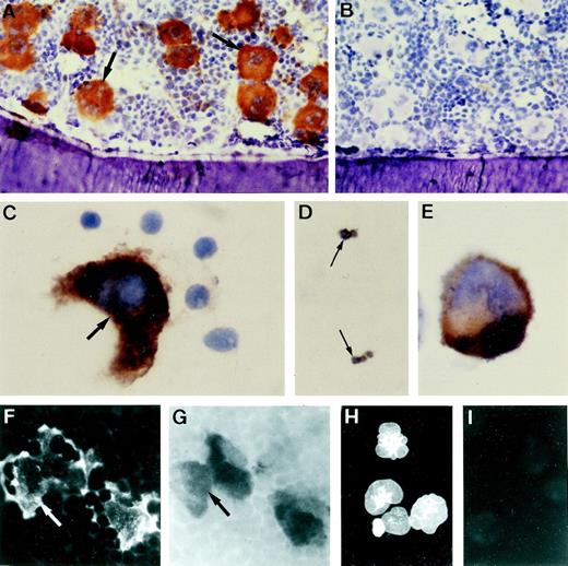 Fig. 2. Immunolocalization of NMDAR1 on megakaryocytes. (A) Cryosection of rat bone indicating intense NMDAR1 immunoreactivity (brown reaction product) on bone marrow megakaryocytes (arrows). (B) Antibody control, hematoxylin counterstain. Positive immunostaining was also identified on human megakaryocytes (C, arrow), human platelets (D, arrows), and MEG-01 cells (E). (F and G) Colocalization studies showed that cells displaying NMDAR1 immunofluorescence in rat bone marrow (F, arrow) were acetylcholinesterase-positive (G, arrow). (H) MEG-01 cells demonstrated strong immunostaining for the glutamate transporter, GLAST. (I) MEG-01 antibody control. Original magnification: A and B, ×250; C, D, and E, ×1,000; F and G, ×500; H and I, ×200.  Fig 3. Binding of the specific NMDA channel blocker, MK-801 to megakaryocytes in vivo. Autoradiography studies localized 3H-MK-801, identified as numerous black silver particles (A, arrows) to NMDAR1-positive (brown staining) megakaryocytes in rat ulna cryosections. Ligand binding was displaced by excess cold MK-801 (B). Original magnification × 1,000.