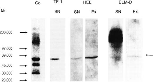 Fig. 8. Immunochemical detection of HS proteoglycan core proteins isolated from hematopoietic progenitor cell lines. Proteoglycans from the human immature erythroid progenitor cell lines TF-1 and HEL and the more mature murine erythroid progenitor cell line ELM-D were treated by heparitinase, submitted to SDS-PAGE on a 4.5% to 15% gradient gel, and subsequently blotted to Biodyne B membrane. Detection was performed using MoAb 3G10 and the ECL-detection system. The MoAb 3G10 recognizes a common neoepitope, generated after heparitinase-digestion of HS proteoglycans.46 This MoAb has been shown to detect most, if not all, HS proteoglycan core proteins after heparitinase-digestion. HS proteoglycans from cervix fibroblasts (cell extract) are shown as positive control (Co, lane 1); supernatant (SN) of TF-1 cells (lane 2), supernatant (lane 3), and cell extract (Ex) (lane 4) of HEL cells; supernatant (lane 5) and cell extract of ELM-D (lane 6). The arrow indicates the HS proteoglycan core protein detected by the MoAb 3G10 in the erythroid progenitor cell lines TF-1, HEL, and ELM-D.