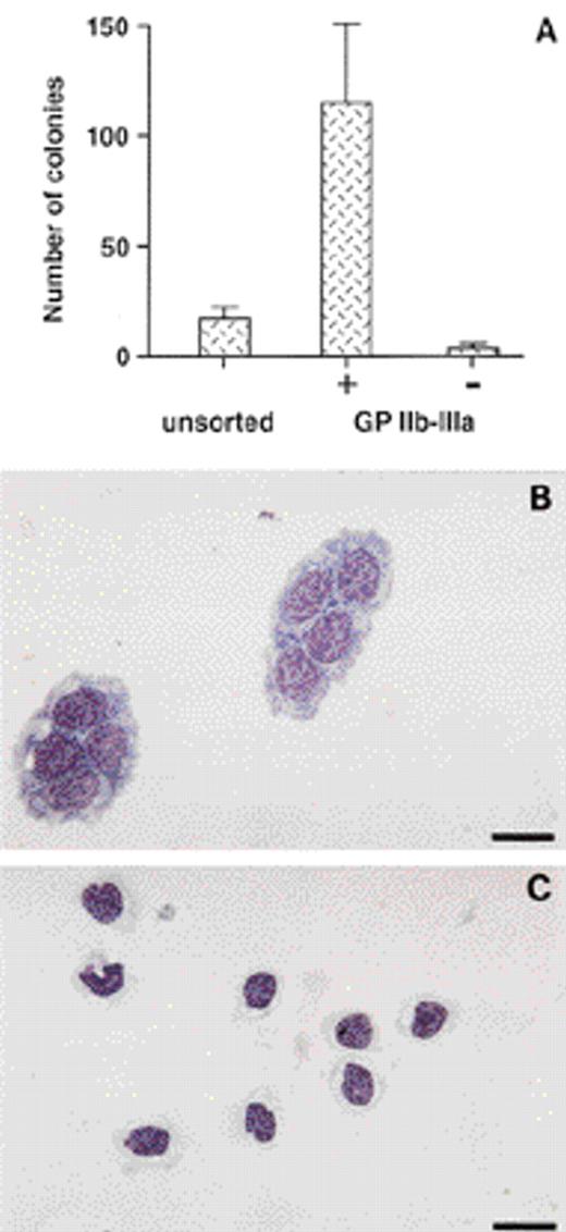 Fig. 1. Distribution of thromboblastic progenitors in embryonic bone marrow. (A) Thromboblastic colonies were scored from sorted GPIIb-IIIa positive (+) and negative (−) populations, and from total E14 bone marrow cells (unsorted) in thromboblastic differentiation medium. Data were normalized to 1,000 cultured cells. Mean ± SD is from eight experiments. (B) Morphology of colonies of thromboblasts (Tb), and (C) thrombocytes (Tc) (MGG staining). These cells were GPIIb-IIIa+ (not shown). Thromboblasts colonies are composed of several clusters. Bar = 12 μm.