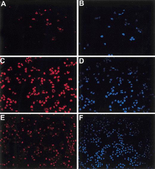 Fig. 5. p21 expression in differentiating myeloid cells. Immunostained cytospins of CD34+ cells cultured for 2 days (top), 6 days (middle), or 11 days (bottom). Cells are stained for p21 expression (red, left) by using indirect Cy-3 conjugated antibody staining. Cell nuclei are counterstained with Hoechst (blue) shown as the same field on the left.