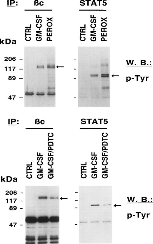 Fig. 3. The redox status in MO7e cells regulates the tyrosine phosphorylation of growth factor receptors and STAT5. MO7e cells were left untreated (CTRL) or treated for 7.5 minutes with either GM-CSF (20 ng/mL), 20 minutes H2O2 (5 mmol/L) (PEROX), or pretreated with 1 mmol/L PDTC for 3 hours and then stimulated with GM-CSF (GM-CSF/PDTC) for 7.5 minutes. Tyrosine-phosphorylated proteins were detected in GM-CSF receptor βc and STAT5 immunoprecipitates by immunoblotting with an antiphosphotyrosine antibody (p-Tyr).