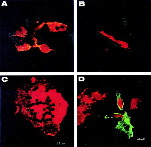 Fig. 3. Immunofluorescence analysis of CECs. (A, B, and C) CECs isolated from donors with AMI or UA. Cells of (D) are mixed endothelial and smooth muscle cells of human umbilical vein for control. All are stained for both intracellular vWF (red) and smooth muscle-specific actin (green). Round- and spindle-shaped cells (A and B), cell sheets (C), and umbilical vein endothelial cells (D) show the same granular pattern of vWF expression. The presence of smooth muscle-specific actin is detected only in control smooth muscle cells (D). Nuclei are counterstained red with propidium iodide. The green halo around beads comes from anti-mouse FITC-secondary antibody bound on the S-endo 1-coated beads.