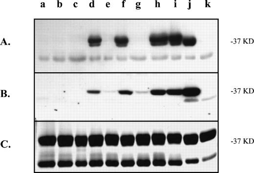 Fig. 4. Recognition of substitution mutations in the N-terminus of the murine GPIIIa by the monoclonal antibody, SZ21. The same modified murine proteins assayed in Fig 2 (samples a-k) were tested for immunoreactivity with the monoclonal antibody, SZ21. The immunoblot with SZ21 (A) can be compared with that with a clinical anti–HPA-1a antibody (B) to illustrate the difference in binding to the position 39-containing mutations. (C) Coomassie blue–stained gel of the proteins. Approximate molecular weight of the protein of interest is indicated on the right. The contaminating GST protein (lower band) is present on the stained gel.