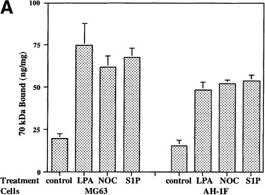 Fig. 1. Binding of 70-kD N-terminal fragment of fibronectin (A) and FITC-fibronectin (B) to confluent cells. (A) Binding of125I-70-kD fragment of fibronectin to MG53 cells (MG63) or human foreskin fibroblasts (AH-1F) was determined in the absence (control) or presence of 200 nmol/L LPA (LPA), 10 μmol/L nocodazole (NOC), or 200 nmol/L S1P (S1P) as described in Materials and Methods. Specific binding was calculated by subtraction of nonspecific binding (in the presence of 500 mg/L unlabeled fibronectin) from total binding and expressed as nanograms of 70-kD fragment bound per milligram of cellular protein. Data represent the mean ± SD (n = 3). (B) Deposition of FITC-fibronectin by confluent MG53 cells was determined after incubation for 1 hour in the absence (control) or presence of 200 nmol/L LPA (LPA), 10 μmol/L nocodazole (NOC), or 200 nmol/L S1P (S1P). Bar = 35 μm.