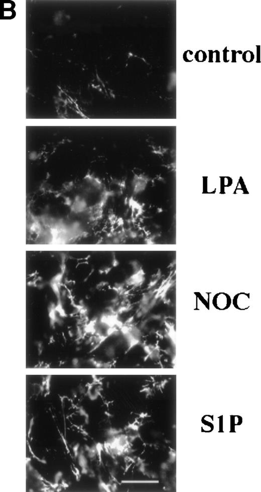Fig. 1. Binding of 70-kD N-terminal fragment of fibronectin (A) and FITC-fibronectin (B) to confluent cells. (A) Binding of125I-70-kD fragment of fibronectin to MG53 cells (MG63) or human foreskin fibroblasts (AH-1F) was determined in the absence (control) or presence of 200 nmol/L LPA (LPA), 10 μmol/L nocodazole (NOC), or 200 nmol/L S1P (S1P) as described in Materials and Methods. Specific binding was calculated by subtraction of nonspecific binding (in the presence of 500 mg/L unlabeled fibronectin) from total binding and expressed as nanograms of 70-kD fragment bound per milligram of cellular protein. Data represent the mean ± SD (n = 3). (B) Deposition of FITC-fibronectin by confluent MG53 cells was determined after incubation for 1 hour in the absence (control) or presence of 200 nmol/L LPA (LPA), 10 μmol/L nocodazole (NOC), or 200 nmol/L S1P (S1P). Bar = 35 μm.