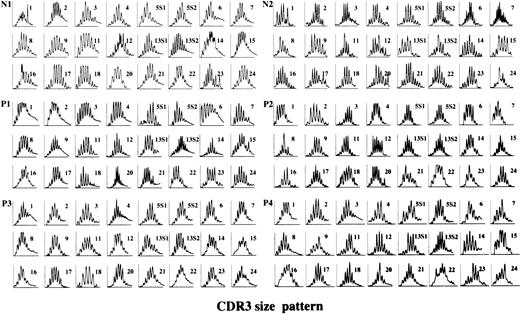 Fig. 1. CDR3 size distribution of TCR BV derived from BM T cells of AA patients who obtained unmaintained remission early after CyA therapy. cDNA that was amplified using primers specific for 24 different BV subfamilies and coupled with a fluorescent BC primer was analyzed for size with the gene scan program. N1 and N2, normals no. 1 and 2 possessing HLA-DRB1*1501; P1-P4, patients no. 1-4. Most BV subfamilies of the patients and normal controls displayed a bell-shaped size pattern with >5 peaks, indicating the predominance of polyclonal T cells.