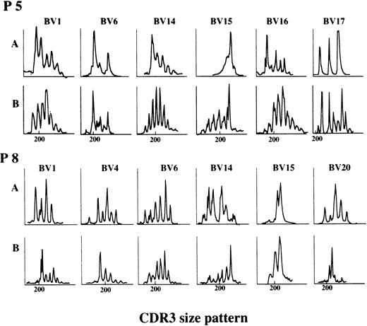 Fig. 5. Changes in CDR3 size patterns associated with achievement of stable remission off CyA therapy. CDR3 size patterns of patient no. 5 (P5) at the time of unmaintained remission after 4 years of CyA therapy and patient no. 8 (P8) in CyA-dependent remission after 7 years of therapy were compared with patterns at the time the disease was active. A, before CyA therapy; B, after CyA therapy.