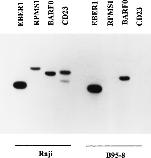 Fig. 2. Specificity of the RT-PCR primers and oligonucleotide probes for EBER1, RPMS1, BARF0, and CD23. RT-PCR and Southern blot analysis were performed as described in Materials and Methods. Raji is a human EBV+ lymphoblastoid cell line that expresses RPMS1, BARF0 and human CD23. B95-8 is a marmoset lymphoblastoid cell line that expresses simian CD23 and carries an EBV genome that is deleted in the BamHI-I region, which encodes RPMS1.