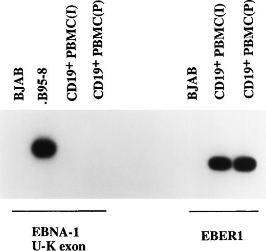 Fig. 3. Examination of EBNA-1 transcription in CD19+ PBMC by RT-PCR. No EBNA-1 transcripts were detected in two CD19+ PBMC samples using primers specific for the EBNA-1 U-K splice, although EBER1 RNA was easily detectable. BJAB and B95-8 cells served as the negative and positive controls.