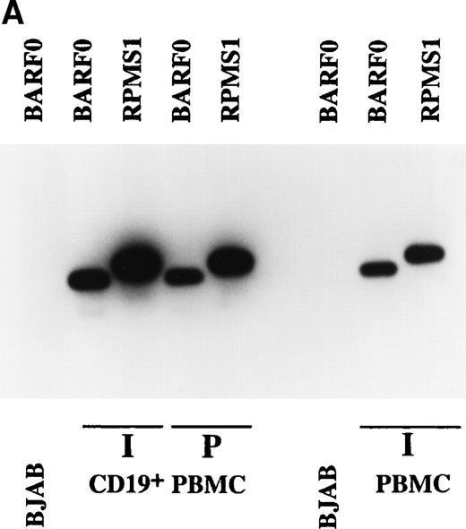 Fig. 4. Expression of BARTs in PBMC. RT-PCR was used to examine BART expression in (A) unfractionated PBMC and CD19+-selected PBMC. RPMS1 and BARF0 were detected in CD19+-selected PBMC isolated from an individual donor (I) and from pooled blood (P), as well as in unfractionated PBMC from an individual (I). EBV− BJAB cells served as the negative control. (B) CD23+ PBMC. RPMS1, BARF0, and EBER1 transcripts were not detected in CD23+ PBMC isolated from an individual (I). Detection of CD23 transcripts in the individual PBMC sample was used to illustrate the quality of the mRNA in this sample. Raji was used as a positive control for CD23 RT-PCR.