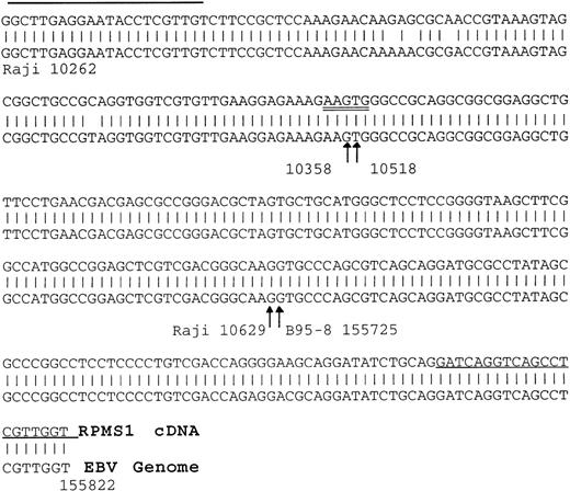 Fig. 5. Verification of the identity of the RPMS1 RT-PCR product. Alignment of an RPMS1 RT-PCR sequence cloned from a CD19+PBMC sample to known EBV sequences. The 5′ part of the sequence matched to Raji sequences spanning the B95-8 major deletion and the 3′ part of sequence matched B95-8 sequences as shown. Arrows indicate the splice sites and the numbers represent the positions in the Raji or B95-8 genome. Single-underlined sequences represent the primers used to generate the RT-PCR clone and the double-underlined 5 bp indicates an insertion relative to a reported cDNA.39The splice acceptor site (115,725) is the same as that seen in RK139 and the same sequence as that seen in C22.2,40 although there is a discrepancy in the numbering, which is given as 115,730 in Smith et al.40