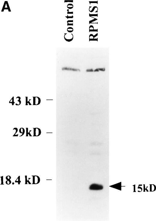Fig. 6. RPMS1 protein expression. (A) Western blot analysis of 293T cells transfected with an expression vector containing the Flag-tagged RPMS1 ORF. The Flag-RPMS1 protein band detected using anti-Flag mouse MoAb is indicated by an arrow. The relative positions of the molecular weight markers are shown on the left. Lysate of nontransfected 293T cells was used as the control. (B) Indirect immunofluorescence assay showing Flag-RPMS1 expression in transfected Vero cells. Flag-RPMS1 was detected using anti-Flag MoAb and FITC-conjugated secondary antibody.
