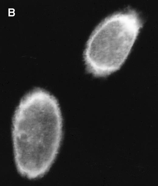 Fig. 6. RPMS1 protein expression. (A) Western blot analysis of 293T cells transfected with an expression vector containing the Flag-tagged RPMS1 ORF. The Flag-RPMS1 protein band detected using anti-Flag mouse MoAb is indicated by an arrow. The relative positions of the molecular weight markers are shown on the left. Lysate of nontransfected 293T cells was used as the control. (B) Indirect immunofluorescence assay showing Flag-RPMS1 expression in transfected Vero cells. Flag-RPMS1 was detected using anti-Flag MoAb and FITC-conjugated secondary antibody.