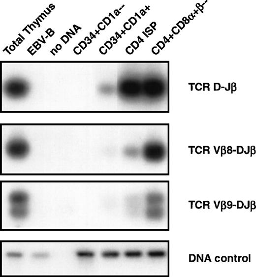 Fig. 4. DNA-PCR analysis of TCRβ gene rearrangements. DNA was isolated from sorted CD34+CD1a−, CD34+CD1a+, CD4 ISP, and CD4+CD8+β− human thymic subsets were sorted as indicated in Materials and Methods and subjected to PCR. Primer combinations were used specifically recognizing TCRβ D-J (first panel), Vβ8-DJ (second panel), and Vβ9-DJ (third panel) as described in Materials and Methods. Amplification of the RAG2 gene was performed to control for the amount of DNA used in the PCR (DNA control, fourth panel). DNA isolated from total thymocytes was used as a positive control and from an EBV-B cell line as a negative control. PCR products were blotted onto nylon filters, and hybridized with endlabeled oligoprobes recognizing sequences different from the primers used for PCR. Filters were washed with 2X SSC, 0.1% sodium dodecyl sulfate and exposed to an autoradiographic film.