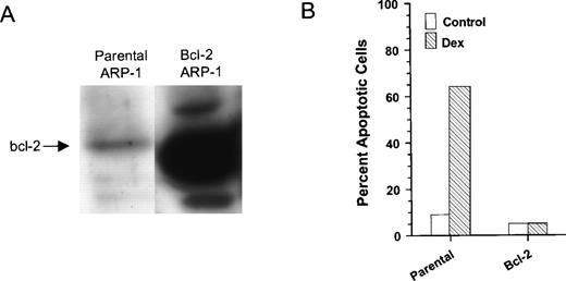 Fig. 1. Overexpression of bcl-2 protects Dex-induced apoptosis in ARP-1 cells. (A) WCEs prepared from parental and bcl-2 ARP-1 transfectants were Western blotted with antibody specific for bcl-2 protein. (B) Parental and bcl-2 ARP-1 transfectants were treated with and without Dex (0.1 μmol/L) for 48 hours. Percentage of apoptosis was measured by ISEL.