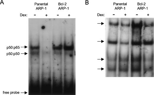 Fig. 2. Enforced bcl-2 prevents the selective downmodulation of NF-κB DNA binding by Dex. Effect of Dex on (A) NF-κB and (B) octamer binding protein (Oct-1) DNA binding activities in parental and bcl-2 ARP-1 transfectants. (A) NEs from parental and bcl-2 ARP-1 transfectants treated with and without Dex (0.1 μmol/L) for 24 hours were incubated with a 32P-labeled probe containing the κB binding site of the IL-6 promoter and assayed by EMSA. (B) The same NEs used in (A) were tested for Oct-1 DNA binding by EMSA using a radiolabeled Oct-1 probe containing a consensus binding site for Oct family homeodomain TFs. Arrows indicate two distinct NF-κB complexes in (A) and four Oct-1 complexes in (B).