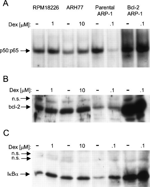 Fig. 7. Correlation between Dex-resistance, constitutive NF-κB DNA binding, and endogenous bcl-2 protein levels. RPMI8226, ARH77, parental, and bcl-2 ARP-1 transfectants were cultured with or without the indicated concentration of Dex for 20 hours (A) WCEs were prepared and analyzed for NF-κB DNA binding by EMSA with a radiolabeled κB probe (B) and (C) WCEs were blotted with antibody specific for (B) bcl-2 and (C) Iκ.