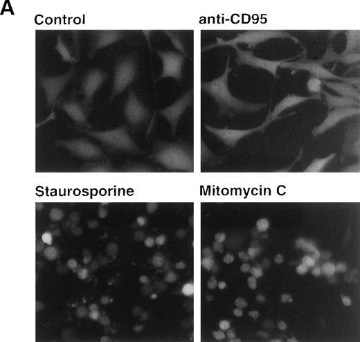 Fig. 8. Drug-induced apoptosis and activation of caspase-8 is independent of FADD signaling. (A and B) HeLa cells (4 × 104) stably expressing a GFP-tagged dominant-negative mutant of FADD (GFPFADD-DN) or the GFP-tagged vector alone (GFPvector) were treated with anti-CD95 (1 μg/mL), staurosporine (2.5 μmol/L), etoposide (25 μg/mL), mitomycin C (25 μg/mL) or left untreated. (A) After 24 hours, HeLa-FADD-DN cells were analyzed for the induction of apoptosis under a fluorescent microscope. (B) Subsequently, HeLa-FADD-DN and HeLa-vector cells were lysed in a hypotonic buffer, and the number of hypodiploid apoptotic nuclei was determined in a flow cytometer. Mean values of ± SD from triplicate experiments are shown. (C) HeLa-FADD-DN (1.5 × 106) or HeLa-vector cells were incubated with medium, anti-CD95 (1 μg/mL), staurosporine (2.5 μmol/L) or mitomycin C (25 μg/mL) for the indicated time. Cellular proteins were immunoblotted with anti-caspase-8 as described in Fig 5A. The intermediate cleavage forms (p43 and p41) of caspase-8a and caspase-8b are shown.