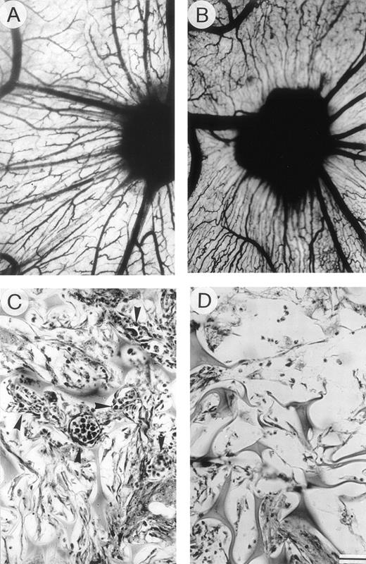 Fig. 2. Angiogenic activity of plasma cell CM: chick embryo CAM-sponge assay. (A) The positive control (RPMI-1640+FGF-2) and (B) the CM of an active MM patient (progression) were loaded onto gelatin sponges implanted on top of the CAM on day 8. Macroscopic appearance of the CAM on day 12: note the presence of numerous blood vessels with a “spoked wheel” pattern around both sponges, highlighted by India ink injection. (C) Histologic section of the sponge sub (B), showing a collagenous matrix pierced by winding blood vessels (arrowheads) containing circulating cells and surrounded by a dense mononuclear cell infiltrate. (D) Histologic section of a sponge loaded with negative control medium (RPMI-1640) and devoid of vessels among the trabeculae. Bar, 3 mm in (A) and (B); 90 μm in (C) and (D).
