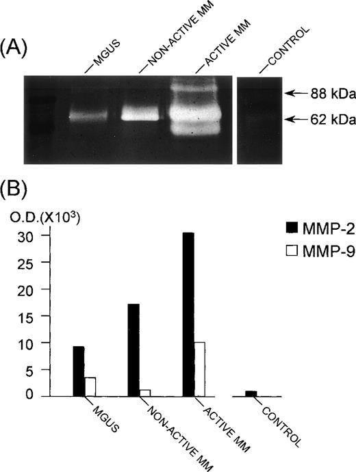 Fig. 6. MMP-2 and MMP-9 secretion by bone marrow plasma cells. The patient with nonactive MM was in the plateau phase; the patient with active MM was at relapse; the control was a patient affected with anemia due to iron deficiency. (A) SDS-PAGE gelatin zymography of plasma cell CM samples. Note the white bands against a dark background with an apparent molecular weight of 62 kD and 88 kD, corresponding to the gelatinolytic regions of activated (cleaved) MMP-2 and MMP-9, respectively. Measurement of the intensity of the bands, as evaluated by computerized image analysis, is shown in (B). The assay was performed in duplicate for each CM. Reproducibility was ≤±20% of the mean intensity value. The lowest (third) band in the lane of the active MM patient represents the 54-kD cleaved form of MMP-2,2 which is sometimes present in the CM of both nonactive and active MM patients, but is not correlated with disease activity.