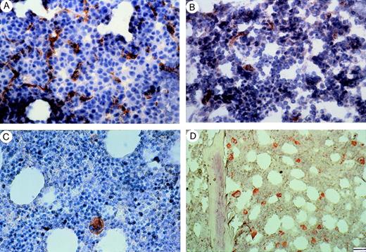 Fig. 1. Staining with factor VIII of bone marrow from patients with (A) MM at relapse, (B) MM at plateau, (C) MGUS, and (D) a control subject (patient with pernicious anemia). Note in (A) numerous microvessels, whereas in (B), a microvessel and some rare endothelial cell clusters and in (C), (D) the lack of vessels in the presence of strongly stained megakaryocytes. Bar, (A) to (C) 40 μm; (D) 55 μm.