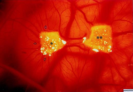 Fig. 5. Macroscopic appearance of a CAM (day 12) implanted simultaneously at day 8 with a sponge loaded with the plasma cell CM of an active (progression) MM patient alone (*) and with a second sponge loaded with the same CM added with an anti–FGF-2 antibody (**). Note the angiogenesis toward the one-asterisk sponge (some neovessels are arrowheaded), and its inhibition by the anti–FGF-2 antibody. Bar, 2 mm.