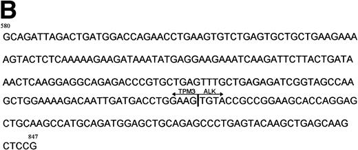 Fig. 4. (A) RT-PCR analysis of TPM3-ALK RNA in 3 cases of ALCL showing ALK-staining restricted to the cytoplasm. RNA obtained from the SU-DHL-1 cell line was used as negative control (T−). RT-PCR was performed using two rounds of PCR. The first round involved C-TPM1 and ALK-1 primers, and the second was a nested amplification using C-TPM3 and ALK-2 primers. PCR products were electrophoresed on 2% agarose gel and visualized with ethidium bromide staining. Two of these three cases of ALCL (cases no. 1 and 3) show a band of 307 bp, indicating the presence of hybrid TPM3-ALK RNA. M, size marker. (B) Nucleotide sequence of hybrid TPM3-ALK transcripts detected by nested RT-PCR using C-TPM3 and ALK2 primers. Nucleotides are numbered from the deoxyadenosine residue of the TPM3 initiator ATG codon.