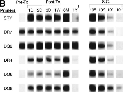 Fig. 7. QAS-PCR results of HLA DR and DQ amplification for samples collected from recipients B (A) and D (B). Pre-tx and serial post-tx samples collected from female trauma tx recipients B and D were amplified with a panel of primer pairs specific to HLA DR (1, 2, 4, 7) and DQ (2, 4, 5, 6, 7, 8) and hybridized with specific probes. The results of DR2 and DQ6 were positive and DQ4 and DQ7 negative at all time points, and are not shown for recipient B; the results of DR1, DR2, DQ4, DQ5, and DQ7 were negative at all time points and are not shown for recipient D.
