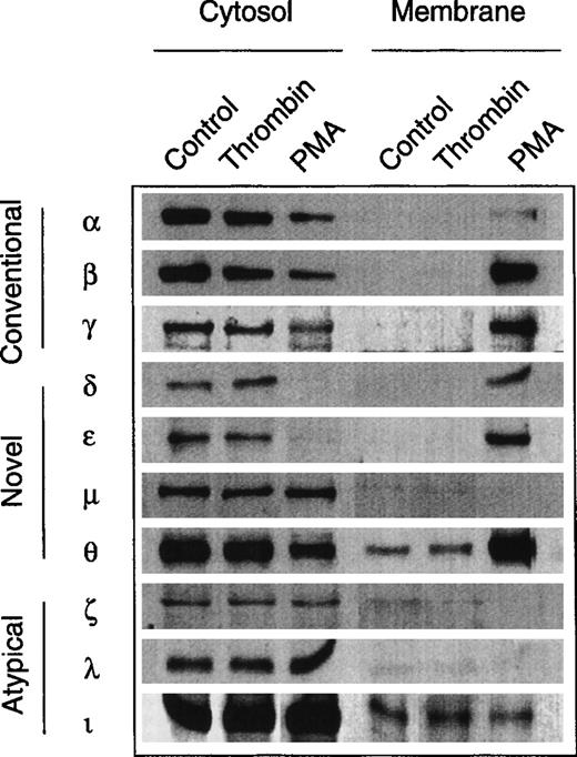 Fig. 6. Expression of PKC isoforms in human erythroid progenitor cells. Members of all three subfamilies (conventional, novel, atypical) were detected by immunolabeling of cytosolic and membrane proteins with specific monoclonal antibodies. PMA (10 nmol/L, 3 to 10 minutes) induced a translocation of the PKC isoforms , β, γ, δ, ɛ, and θ to the membrane fraction. By contrast, thrombin (2 to 10 U/mL, 3 to 10 minutes) did not affect the subcellular distribution of the enzymes. Apparent membrane association of θ- and ι-kinases may be due to a minor contamination of the particulate fraction with cytosol.